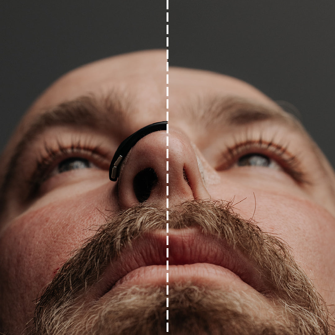 Comparación visual de la nariz con y sin banda magnética