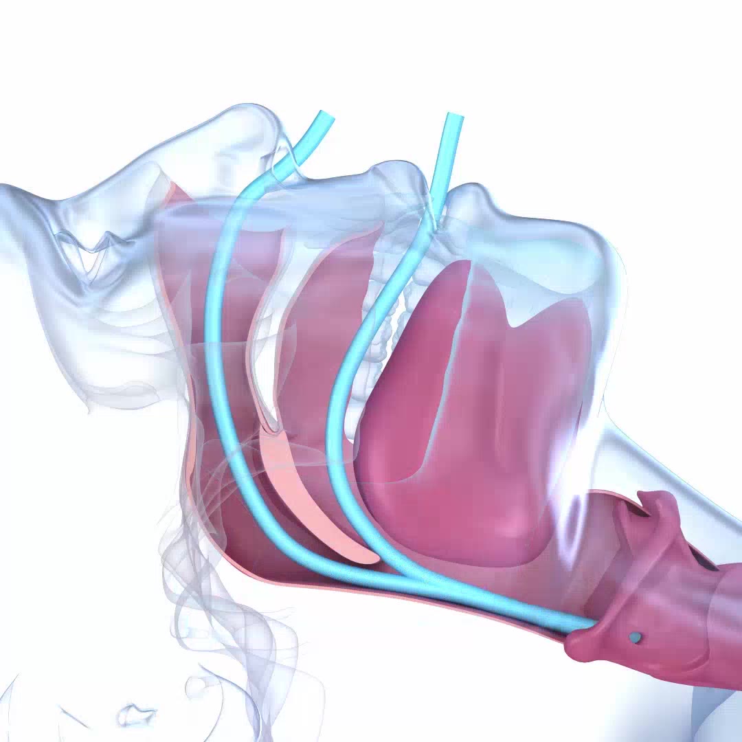 Animación de las vías respiratorias